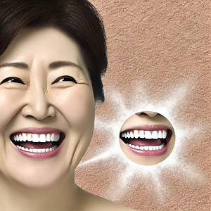 치아가 시릴 때 의심해야 할 치과 질환
