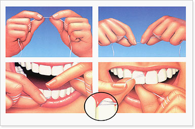 치실(dental floss silk)
